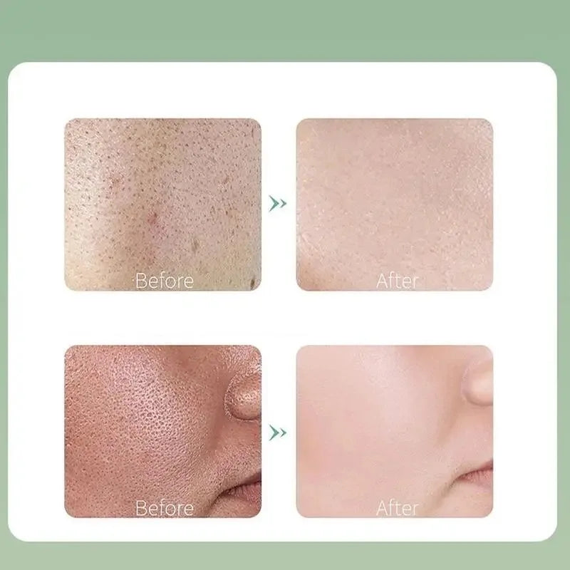 Deep Cleansing Mask (4g×12pcs/Box)  (Available)